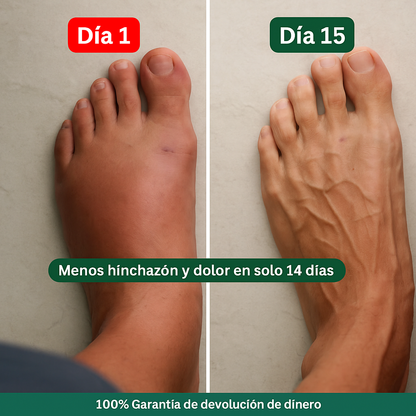 Medias de compresión-VitaLegs®- para piernas pesadas y doloridas